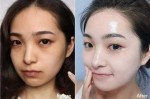 怎么让自己的脸变白（怎样才能让脸变白）
