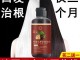 治疗白发最好的方法,什么冶白发洗发露