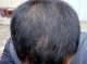 17岁男生为什么洗头老是掉头发,男人为什么容易脱发的原因