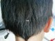 头发剪薄了怎么办（头发削得太薄了，有个么补救措施吗）