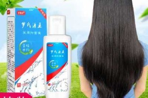 怎样洗头才能去屑止痒,用什么洗头去屑止痒效果好