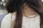 烫发之后头发一碰就断，现在头发感觉断了很多，怎么办啊？有什么办法,头发很容易断是什么原因造成的