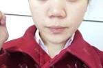 塌鼻梁是什么样的图片（塌鼻梁是什么样的图片大全）