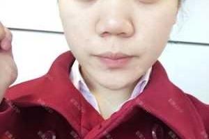 塌鼻梁是什么样的图片（塌鼻梁是什么样的图片大全）