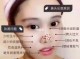 女生鼻子上长痘痘是什么原因（女生鼻子上长痘痘是什么原因引起的）