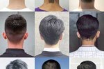 后脑勺大适合什么发型（后脑勺大适合什么发型男）