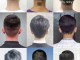后脑勺大适合什么发型（后脑勺大适合什么发型男）