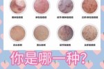 痘痘怎么根除（痘痘怎么根除广西）
