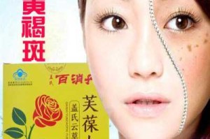 妊娠斑吃什么能去掉,孕斑怎样才能消除掉