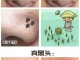 鼻子上有黑头怎么去除,13岁鼻子上好多黑头怎么办
