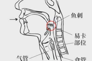 鱼刺怎么发（鱼刺怎么发制）