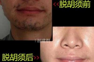 男人去胡子最好的方法,