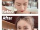 发际线后移怎么补救女士发型,女发际线后移怎么办图片
