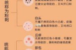 怎么能去痘印吗（怎样可以去痘印?）