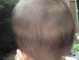 为什么有些有钱人家的孩子长得漂亮呢,宝宝头发很好是什么原因