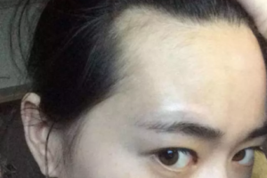 发际线长是什么意思,发际线是什么意思图片