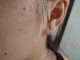 男生脸上怎么长肉（怎样可以使脸上长肉）