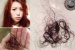 烫完头发掉发正常吗,烫发后大量脱发怎么办女生