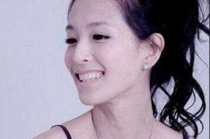 前秃适合什么发型（前秃适合什么发型女）