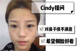 扁平脸怎么办（面中扁平怎么改善）