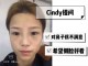 扁平脸怎么办（面中扁平怎么改善）