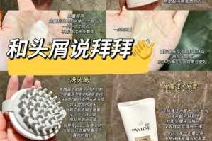 头皮屑怎么去（去屑小方法）