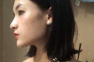 本人脸长，下巴较尖，穿什么样的衣服好看?怎样搭配,下巴长怎么整形