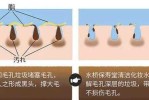 怎么样可以去掉黑头,有什么方法去除黑头最有效