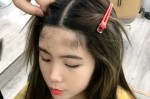 脑门长头发是怎么回事（脑门长头发是怎么回事儿）