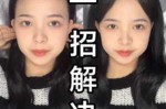 脑门小怎么办（额头小脸大怎么瘦脸）