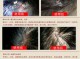 怎么治头屑（怎么治头屑最好的方法）