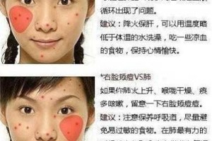 怎么消脸上的痘痘（怎么消脸上的痘痘）