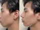 下巴后缩适合什么发型（下巴后缩适合什么发型男）