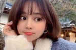 婴儿肥适合什么刘海（婴儿肥适合什么刘海女）