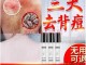 背部长痘用什么药,冬天背上长痘是什么原因