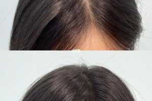 为什么有的人头发很厚,头发厚是什么原因导致的?