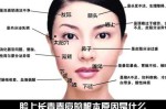 鼻子两侧长痘痘是什么原因造成的,鼻头为什么长痘痘的原因