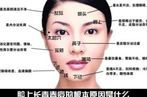 鼻子两侧长痘痘是什么原因造成的,鼻头为什么长痘痘的原因