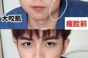 怎么变v型脸（怎么变v型脸13男）