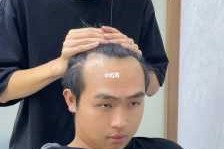 男人头发少怎么办（男人头发少怎么办）