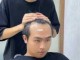 男人头发少怎么办（男人头发少怎么办）