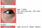 脂肪粒怎么形成的（为什么油脂粒会从毛孔里自己出来）