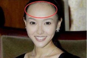 额头又高又凸怎么办（额头又高又凸怎么办女面相）