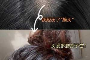 头发掉的太多怎么办（家里面头发掉的太多怎么办）