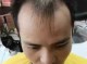 男士前秃适合什么发型（男士前秃适合什么发型视频）
