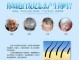 年轻人长白头发怎么回事,长白头发缺什么维生素