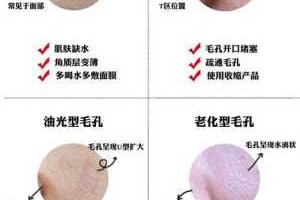 脸毛孔粗怎么办,粗毛孔怎么办小妙招