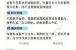 去粉刺最快的方法,怎么去粉刺最快最有效的方法