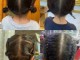 1-3岁的编发发型,小孩的头发怎么扎才好看