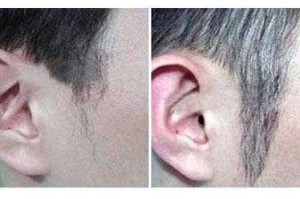 怎么留长鬓角,鬓角怎么长出来